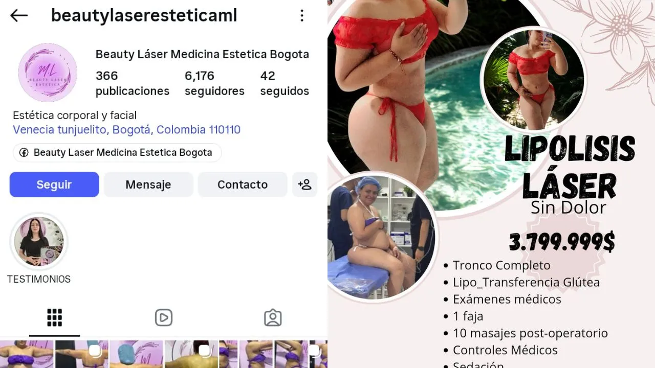 imagen dada